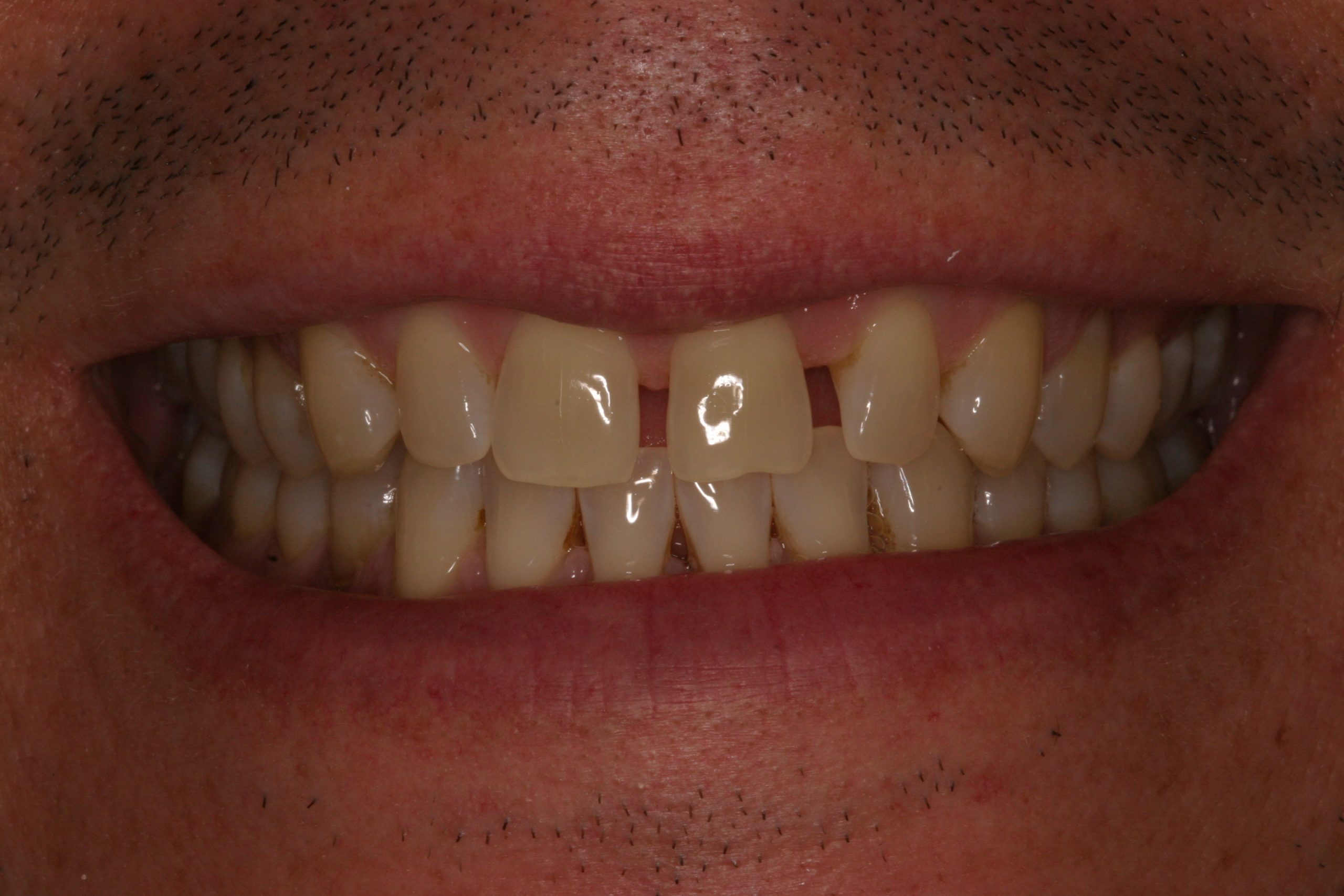 Figure 23 before spaces