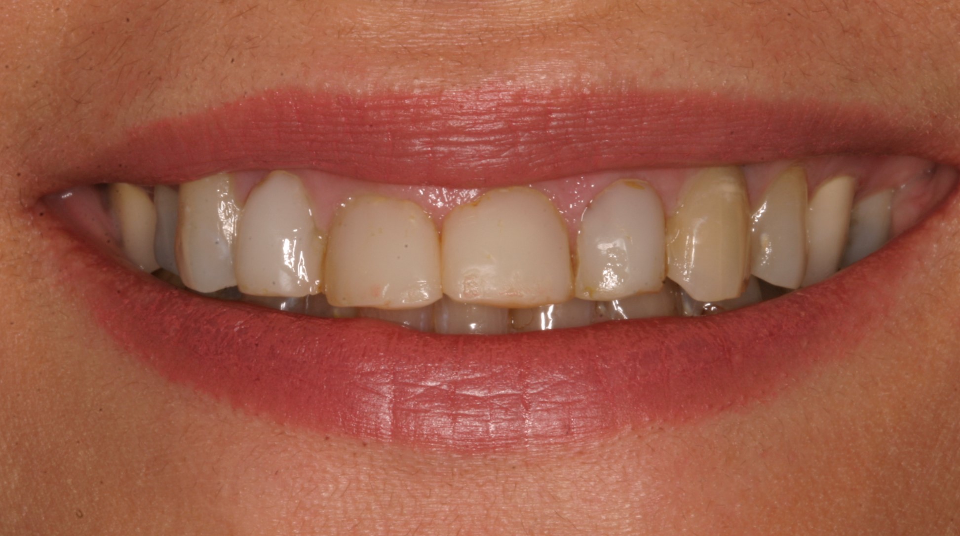 Shiva before worn teeth